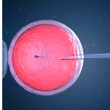 iui